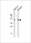 LAG3 Antibody (Center)